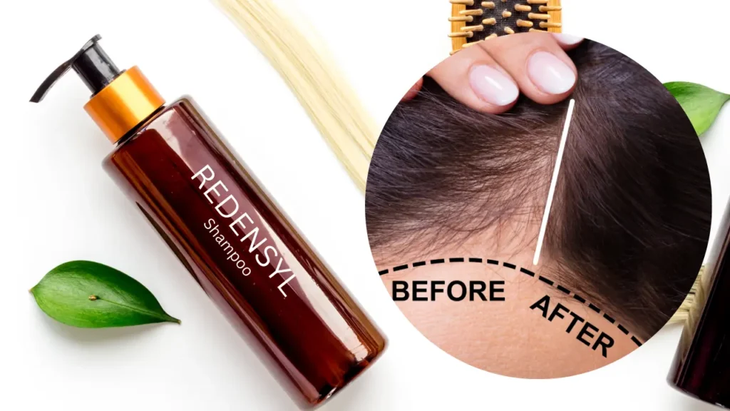 Redensyl - A Revolutionary Hair Growth Ingredient